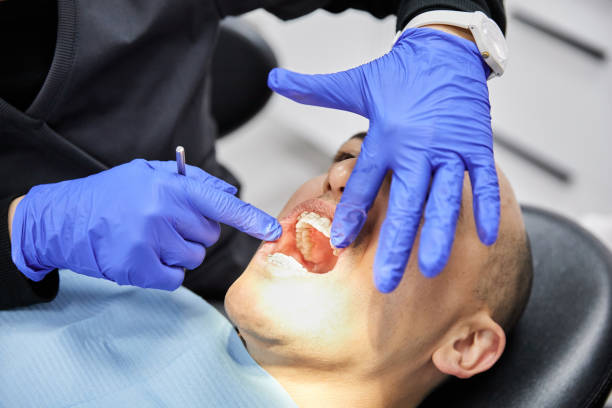Best Emergency Dental Care for Broken or Chipped Teeth in Altus, OK